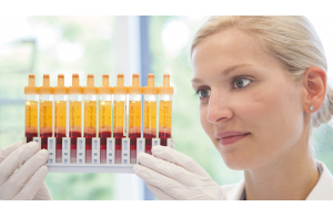 Download Sarstedt Ag &amp; Co. Kg Nümbrecht Pics